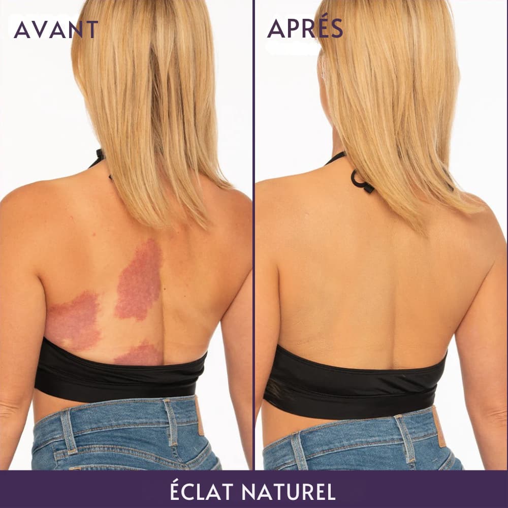 Lissea-Paris : Adoptez une peau parfaite