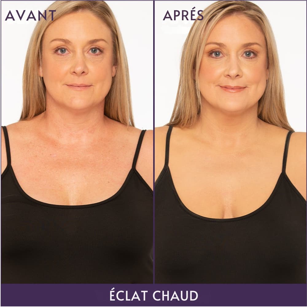 Correcteur d'imperfections LISSEA PARIS