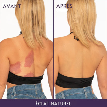 Lissea-Paris : Adoptez une peau parfaite